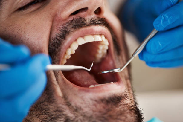 Best Broken or Cracked Tooth Emergency Dentist in Wrightsboro, NC