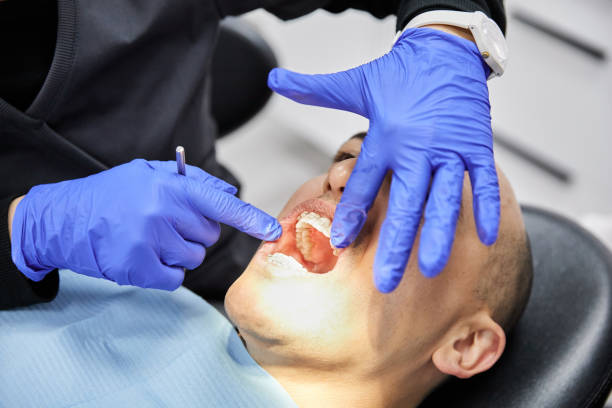 Best Emergency Dental Care for Abscessed Tooth in Wrightsboro, NC